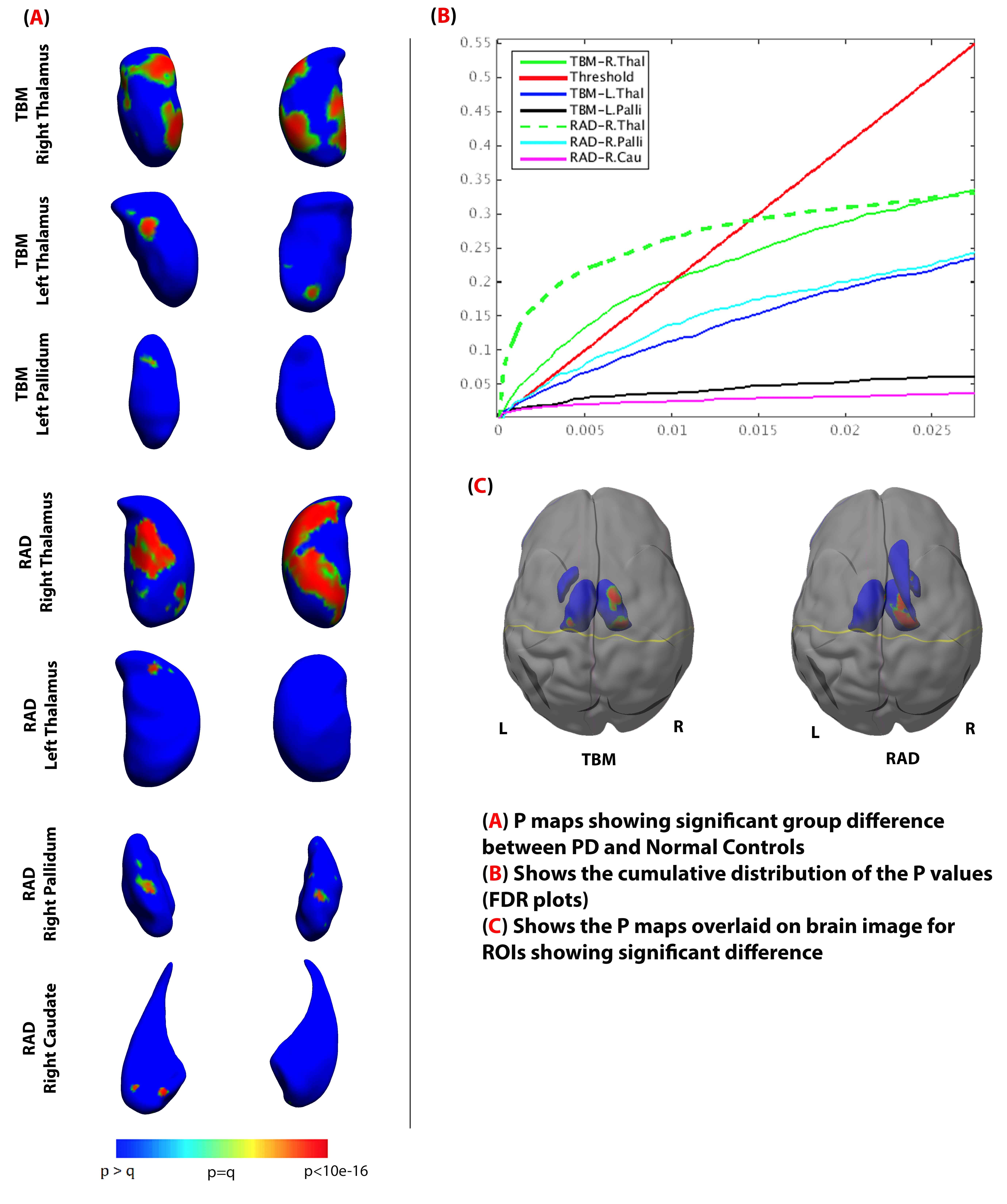 SfN_abstract_PPMI_Shape_v3